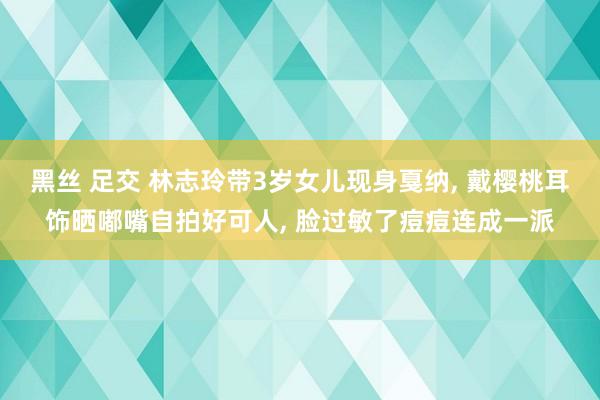 黑丝 足交 林志玲带3岁女儿现身戛纳， 戴樱桃耳饰晒嘟嘴自拍好可人， 脸过敏了痘痘连成一派
